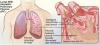 Photo for Pulmonary Fibrosis-Global API Manufacturers, Marketed and Phase III Drugs Landscape, 2017