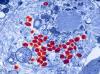 Photo for Smallpox-Global API Manufacturers, Marketed and Phase III Drugs Landscape, 2017
