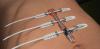 Photo for Global Wound Closures Devices Market Research Report Forecast 2017 to 2021