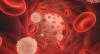 Photo for Thrombocytopenia-Global API Manufacturers, Marketed and Phase III Drugs Landscape, 2017
