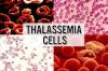 Photo for Thalassemia-Global API Manufacturers, Marketed and Phase III Drugs Landscape, 2017