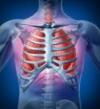 Photo for Ventilator Associated Pneumonia (VAP)-Global API Manufacturers, Marketed and Phase III Drugs Landscape, 2017