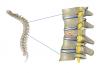 Photo for Global Vertebral Compression Fracture Devices Market Research Report 2016