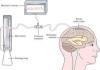 Photo for Global High-pressure Sodium Light Market Research Report 2017