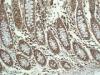 Photo for Prostaglandin E Receptor 2 (EP2 or Prostaglandin E2 Receptor EP2 Subtype) Agonists -Pipeline Insights, 2017