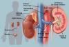 Photo for Diabetic Nephropathy – Market Insights, Epidemiology and Market Forecast-2023