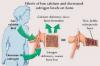 Photo for Post Menopausal Osteoporosis – Market Insights, Epidemiology and Market Forecast-2023