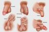 Photo for Genital Herpes – Market Insights, Epidemiology and Market Forecast-2023