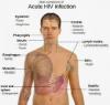 Photo for HIV-associated Lipodystrophy- Market Insights, Epidemiology and Market Forecast-2023