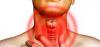 Photo for Hyperthyroidism – Market Insights, Epidemiology and Market Forecast-2023