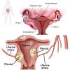 Photo for Dysmenorrhea  – Market Insights, Epidemiology and Market Forecast-2023