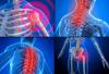 Photo for Fibromyalgia  – Market Insights, Epidemiology and Market Forecast-2023