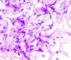 Photo for Candidiasis  – Market Insights, Epidemiology and Market Forecast-2023