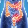 Photo for EpiCast Report: Clostridium Difficile Infection (CDI) - Epidemiology Forecast to 2024
