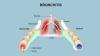 Photo for Bronchitis  – Market Insights, Epidemiology and Market Forecast-2023