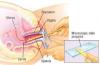 Photo for Postmenopausal Vaginal Atrophy  – Market Insights, Epidemiology and Market Forecast-2023