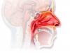 Photo for Allergic Rhinitis – Market Insights, Epidemiology and Market Forecast-2023