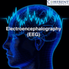 Photo for Electroencephalographs Market - Global Industry Insights, Trends, Size, Share, and Opportunity Analysis, 2017–2025