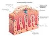 Photo for Psoriasis – Market Insights, Epidemiology and Market Forecast-2023