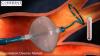 Photo for Global Cryoablation Devices Market - Insights, Size, Share, Analysis, and Industry Forecast till 2025