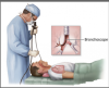 Photo for Bronchoscopes Market - Global Industry Insights, Trends, and Opportunity Analysis, 2017–2025
