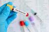 Photo for EMEA (Europe, Middle East and Africa) Cancer Biomarkers Market Report 2017