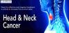 Photo for Head and Neck Cancer Market - Global Industry Insights, Trends, Outlook, and Analysis, 2017-2025