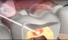 Photo for Tooth Regeneration Market - Global Industry Insights, Trends, Outlook, and Opportunity Analysis, 2016-2024