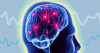 Photo for Brain Monitoring Market - Global Industry Insights, Trends