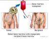 Photo for EMEA (Europe, Middle East and Africa) Hematopoietic Stem Cell Transplantation (HSCT) Market Report 2017