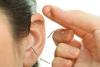 Photo for Acupuncture Treatment for Depression, Acupuncture for Weight Loss and Laser Acupuncture - Tustin