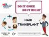 Photo for Hair Transplant Surgery – How is the surgery performed?