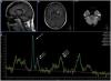 Photo for Global Magnetic Resonance Spectroscopy (MRS) Market Research Report 2017