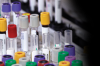Photo for 2017 Global IVD Reagents Market Research Report