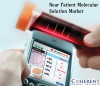 Photo for Near Patient Molecular Solution Market - Global Industry Insights, Trends, and Opportunity Analysis, 2016-2024