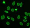 Photo for Antinuclear Antibody Test Market Size & Share Outlook up to 2024