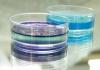 Photo for United States Hydrogel Market Report 2017