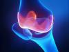 Photo for Global Orthobiologics Market Outlook 2020