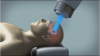 Photo for US Proton Therapy Market Forecast to 2022
