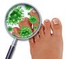 Photo for Anti-Fungal Drugs Market – Global Industry Insights, Trends