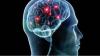 Photo for Ischemic Cerebral Stroke Market: An Overview of Growth Factors