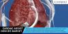 Photo for Cardiac Assist Devices Market – Global Industry Insights, Trends, and Opportunity Analysis, 2016–2024