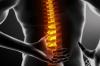 Photo for Spine Biologics Market: By Type, Application, Size, Growth, Analysis & Forecast 2024