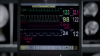 Photo for Global Vital Signs Monitors Industry Situation and Prospects Research report 201