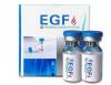 Photo for Epidermal Growth Factors Market - Global Industry Insights, Trends, Size, Share, and Analysis, 2017-2025