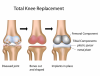 Photo for Knee Surgery Hospitals in Chennai