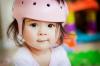 Photo for Global Cranial Remolding Helmet Market Research Report 2017