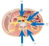 Photo for Global Lateral Lumbar Interbody Fusion Market by Manufacturers, Countries, Type and Application, Forecast to 2022