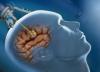 Photo for Global Brain Surgical Robot Market Research Report 2017