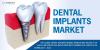 Photo for Global Dental Implants Market - Global Industry Insights, Size, Share, Trends, and Opportunity Analysis, 2024